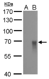 Anti-Influenza A virus H1N1 HA (Hemagglutinin) antibody [GT521] used in Western Blot (WB). GTX629746